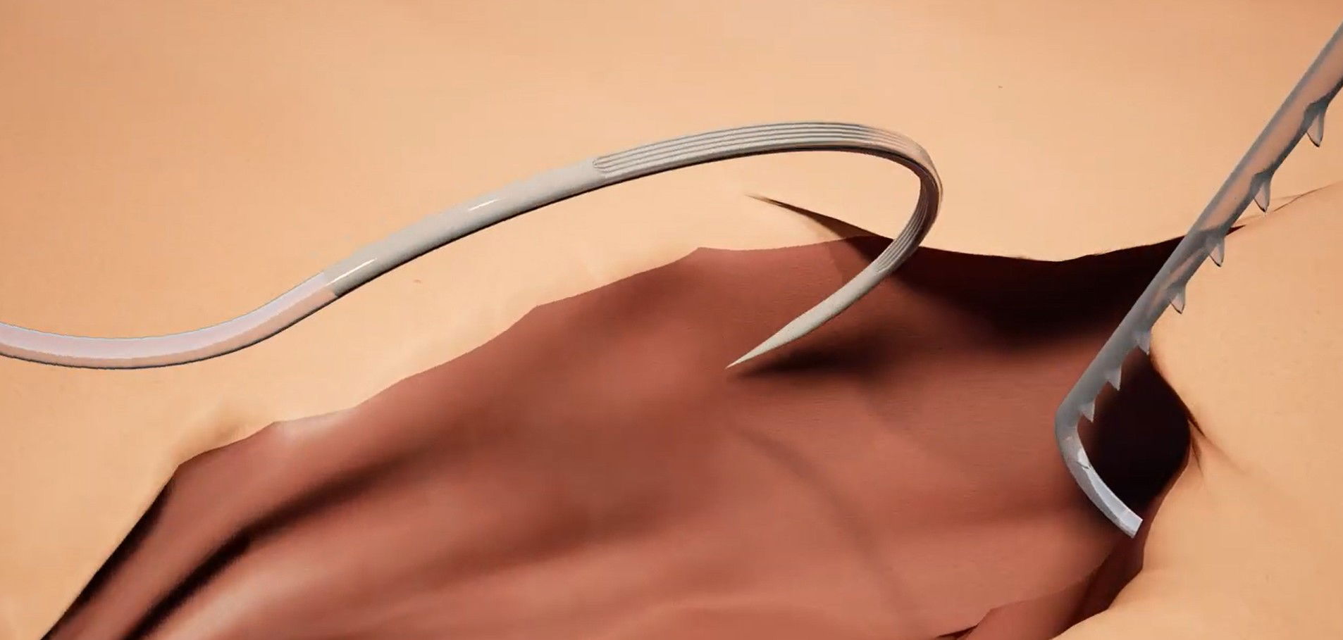 Você já ouviu falar no famoso fio farpado?