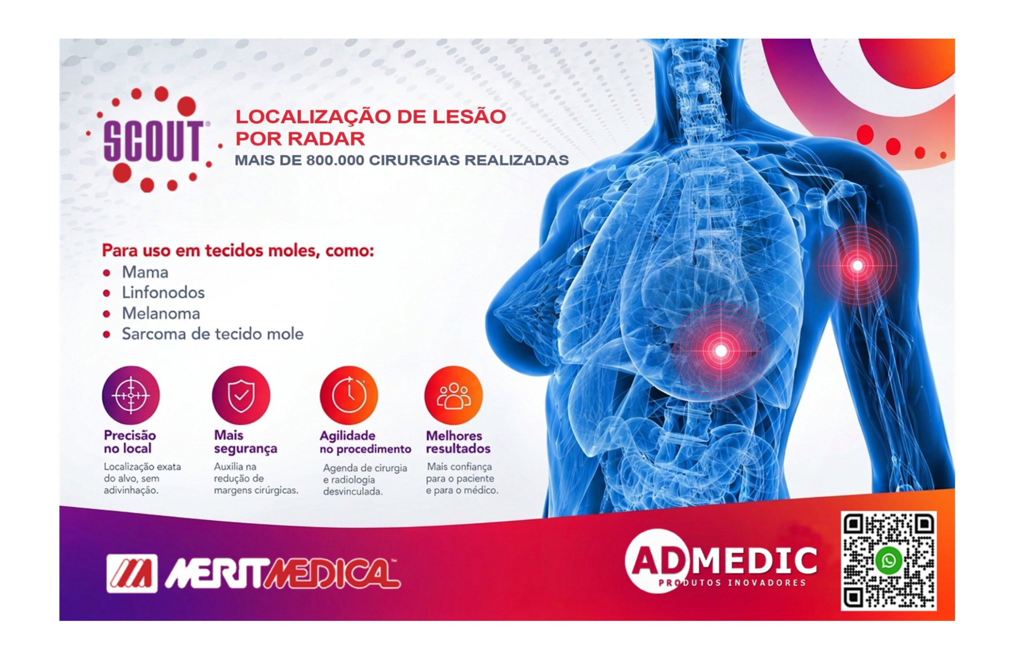 A Revolução na Cirurgia do Câncer de Mama: Como a Tecnologia SCOUT® Redefine a Precisão e o Conforto