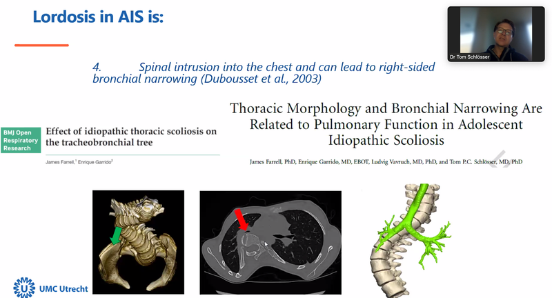 SOSORT Presents - Respiratory impairments and their implications for Scoliosis management: An evidence-based analysis.