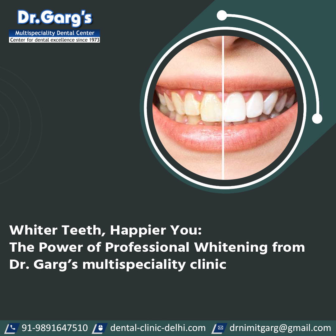 ProfessionalTeethWhitening