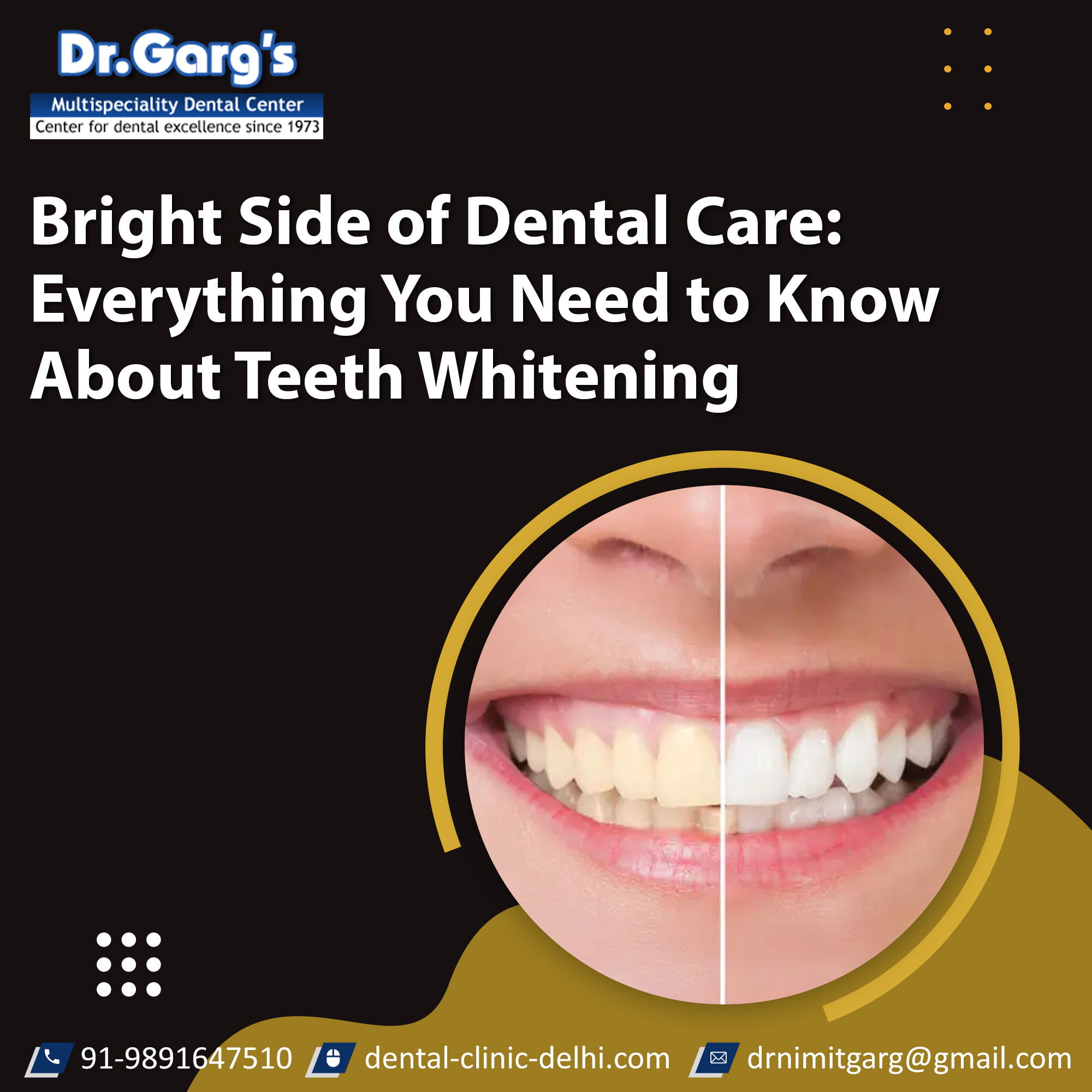 normal 6704e319925af - The Bright Side of Dental Care: Everything You Need to Know About Teeth Whitening