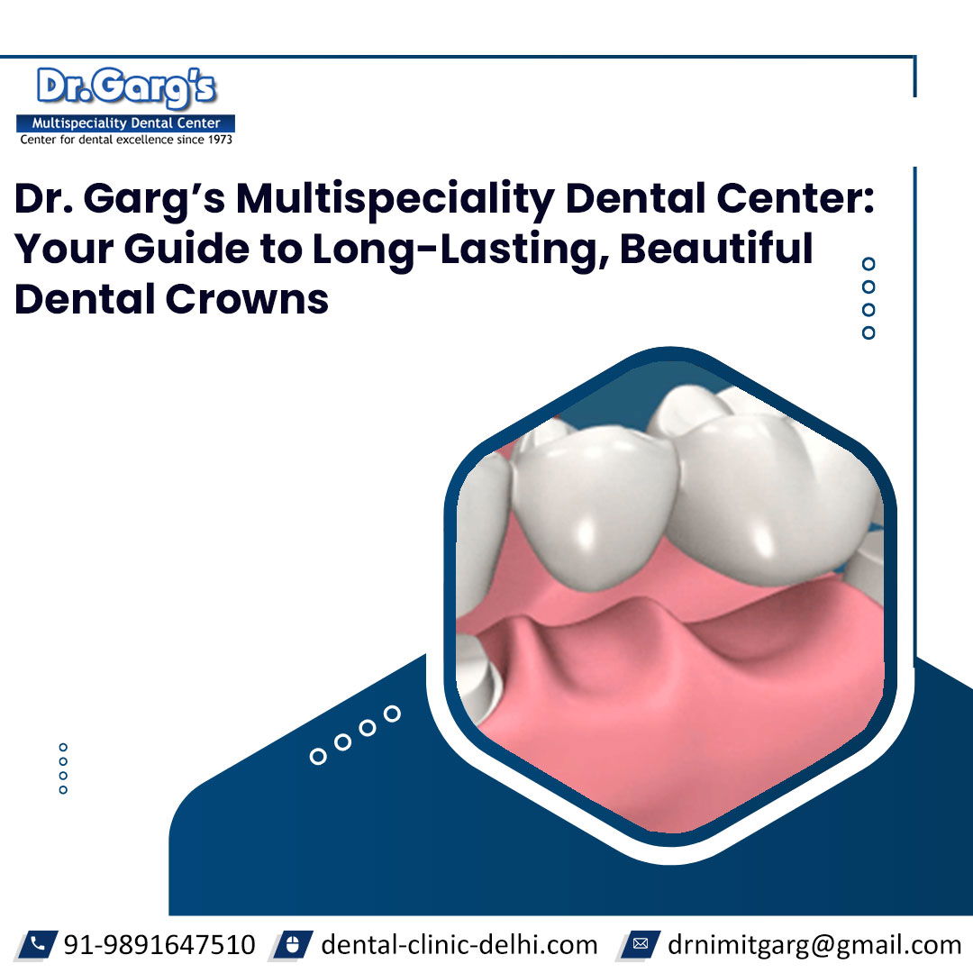 Porcelain crowns