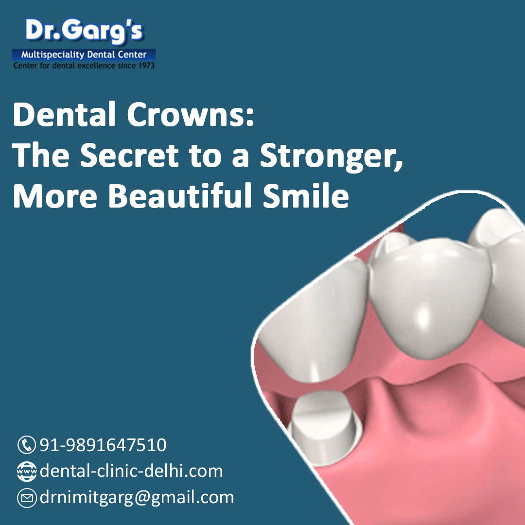 Dr. Garg’s Multispeciality Dental Center for dental crown, ceramic crown, captek crown, metal crown, Porcelain crowns,zirconia crowns