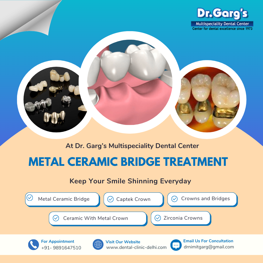 metal ceramic bridge