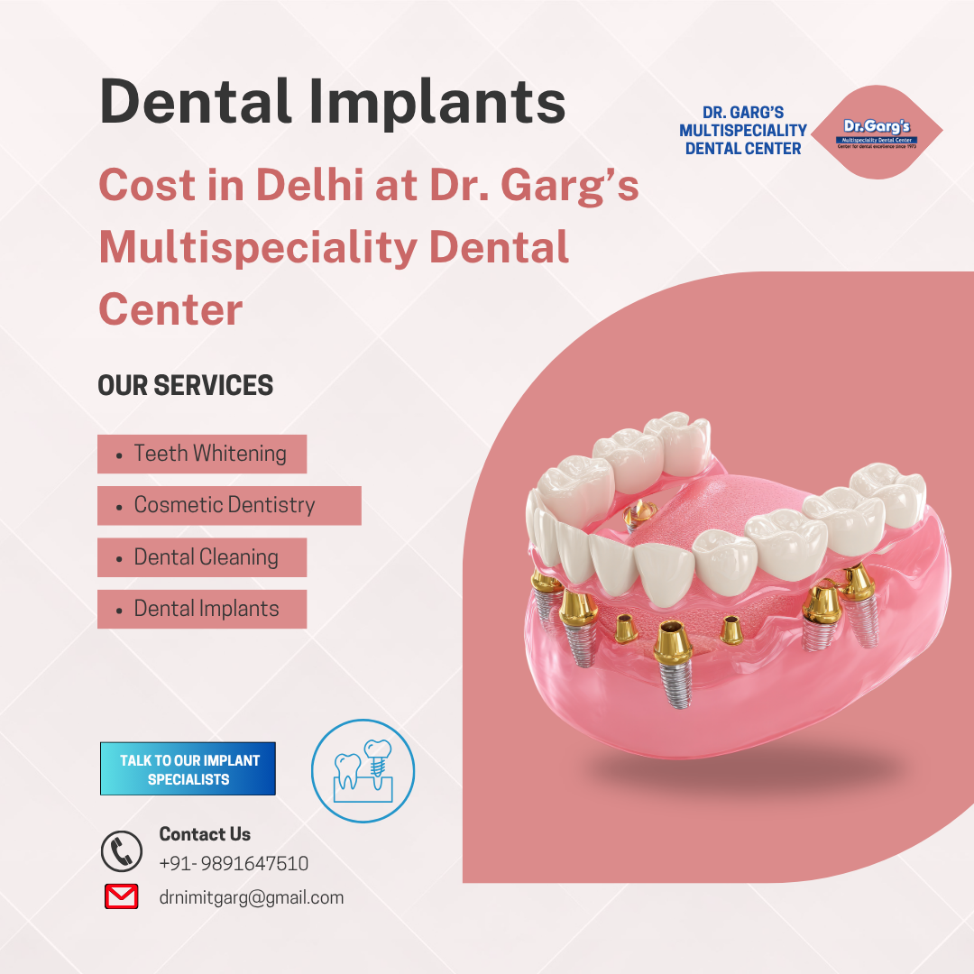 dental implant cost in delhi