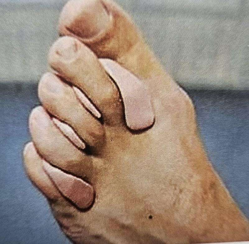 Orthese behandeling
