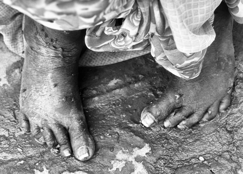 Black & White Faces of The World