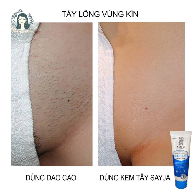 Tẩy lông vùng kín bằng kem và bằng dao cạo