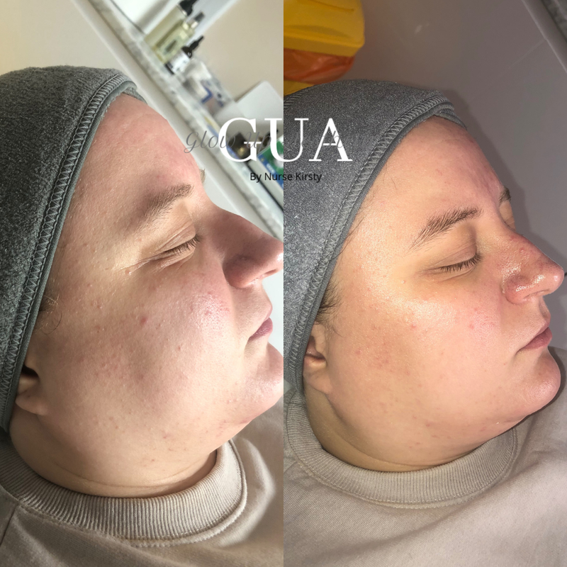 Deluxe luxury facial