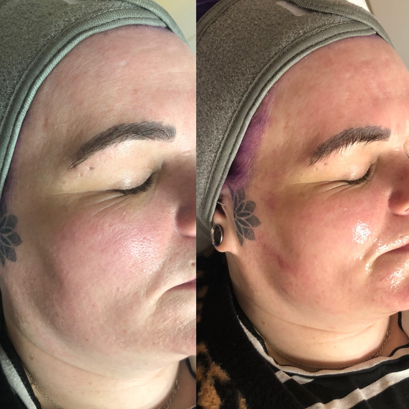 Glow ups Signature facial