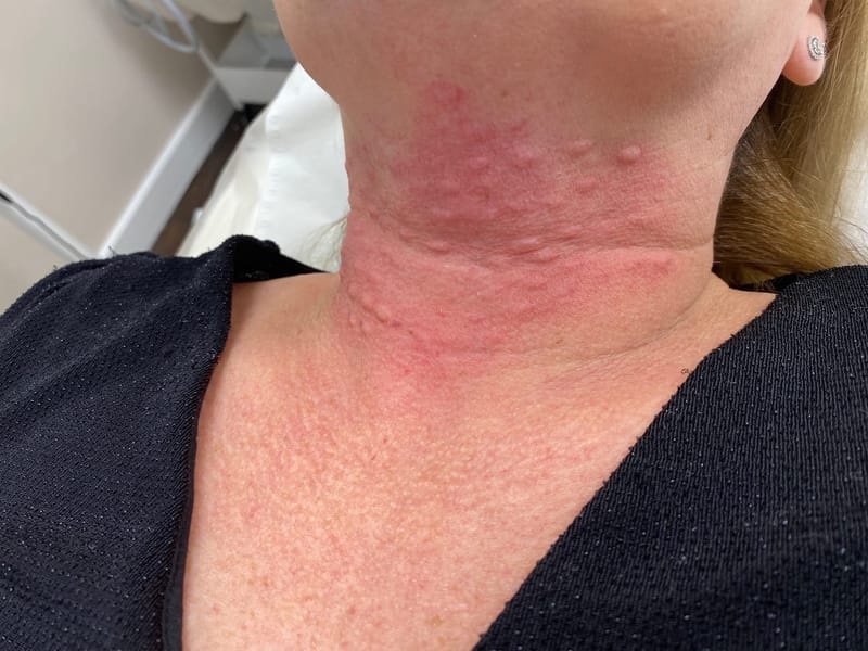 Polynucliotides (Salmon DNA)