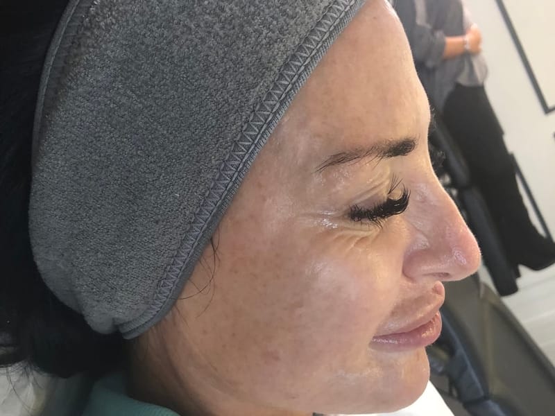 Cinderella / Black tie facial