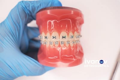 How to Choose the Best Rated Orthodontist Near You in One Visit
