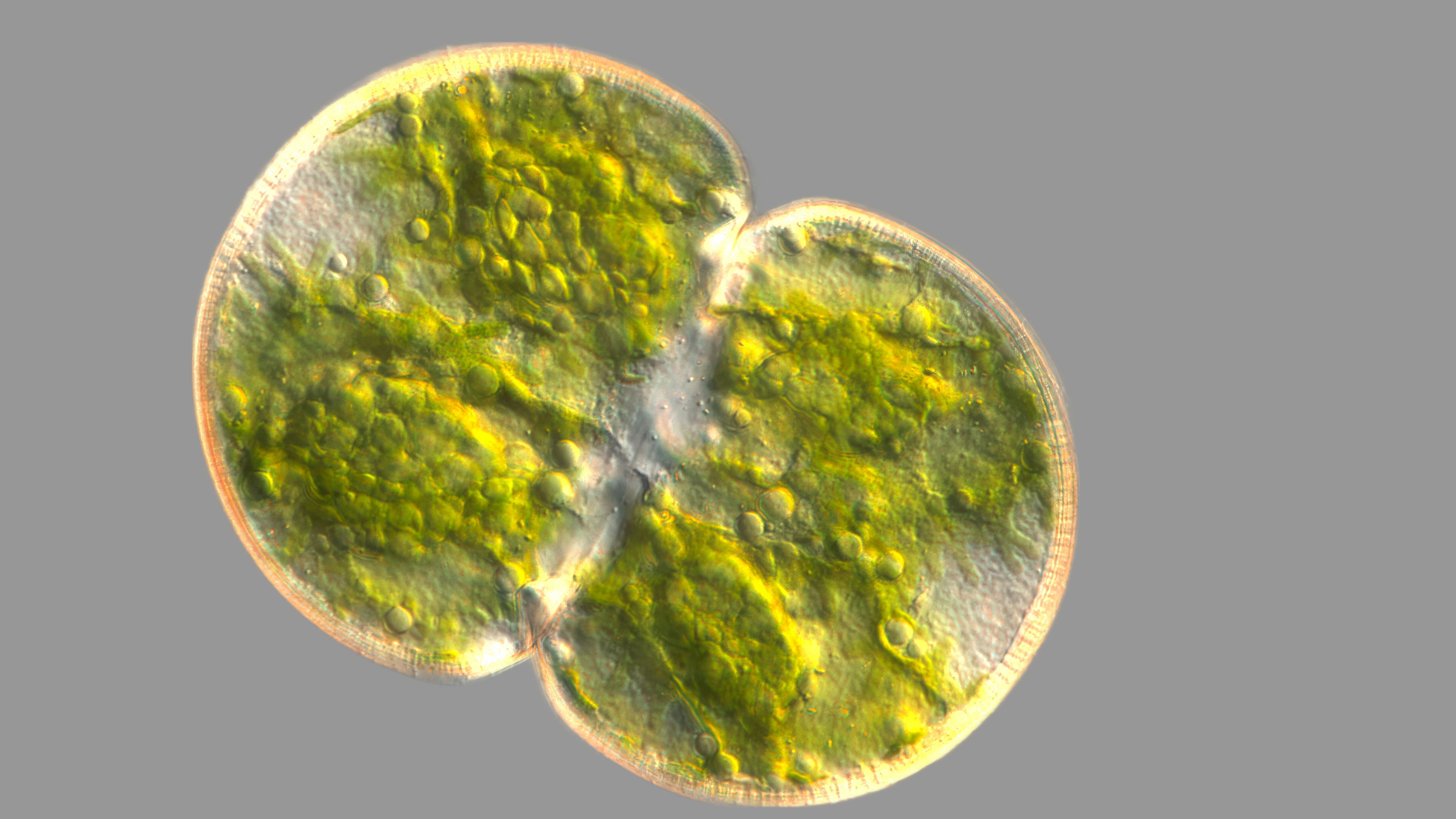 Cosmarium pachidermum