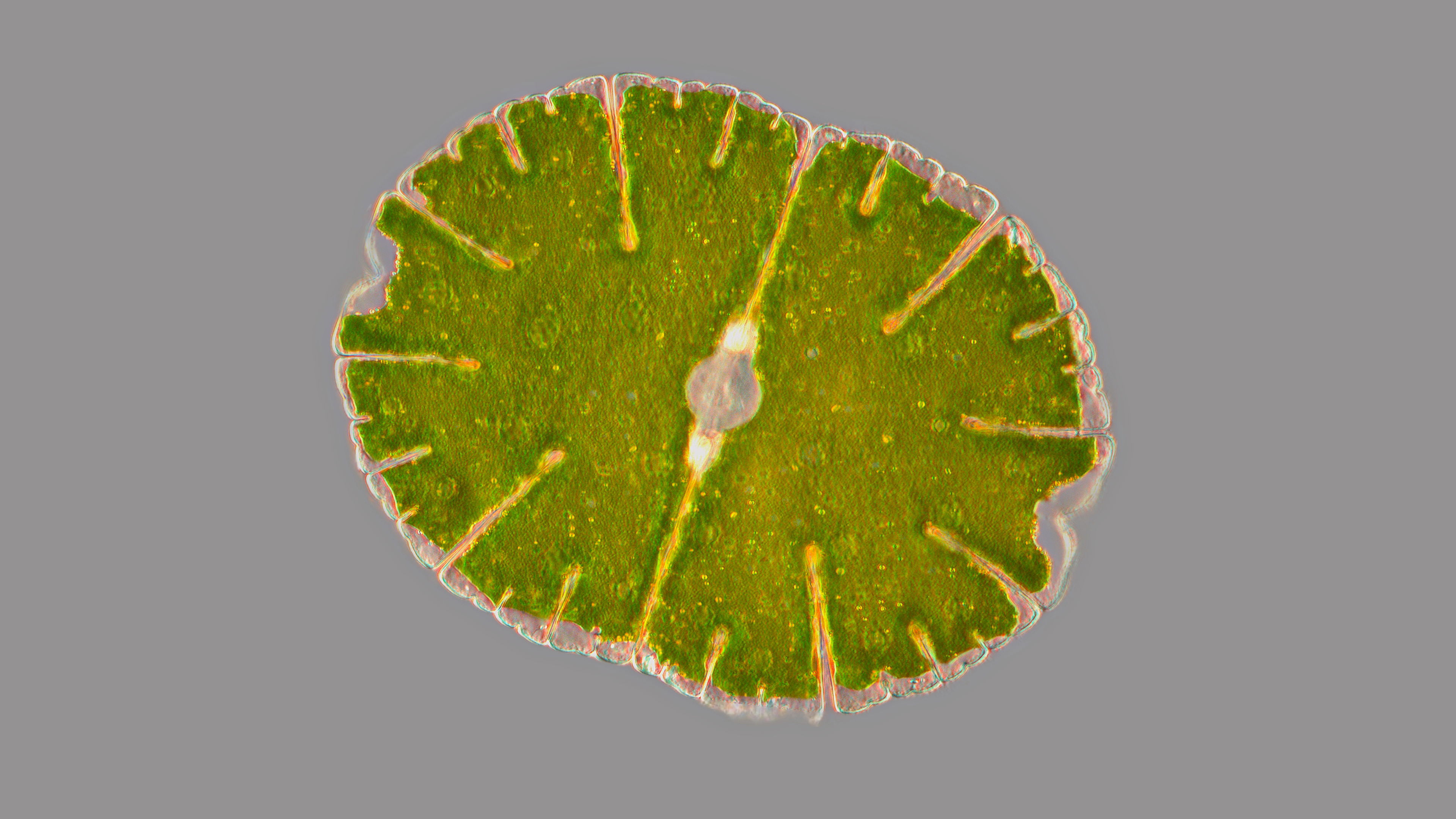 Micrasterias denticulata