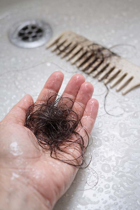 Hair loss after showering: normal or a problem? Causes + what to do immediately