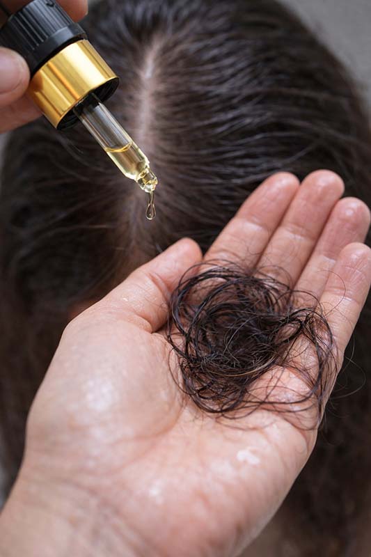 Why does hair loss increase after applying oil? Common causes + how to avoid them