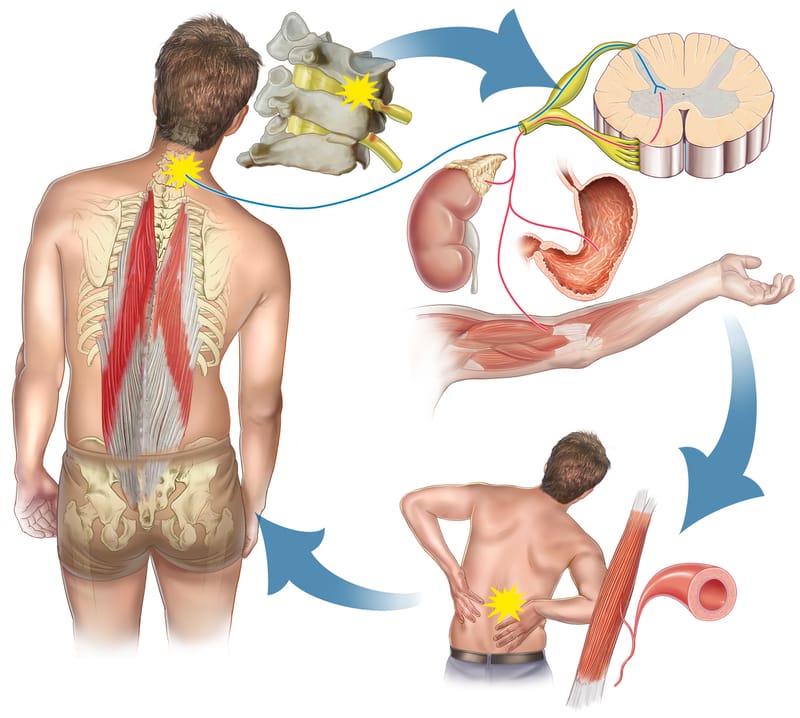 Forces de tension déséquilibrées