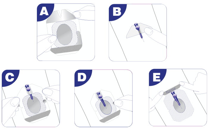 TRANSPARENT IV CANNULA DRESSING.