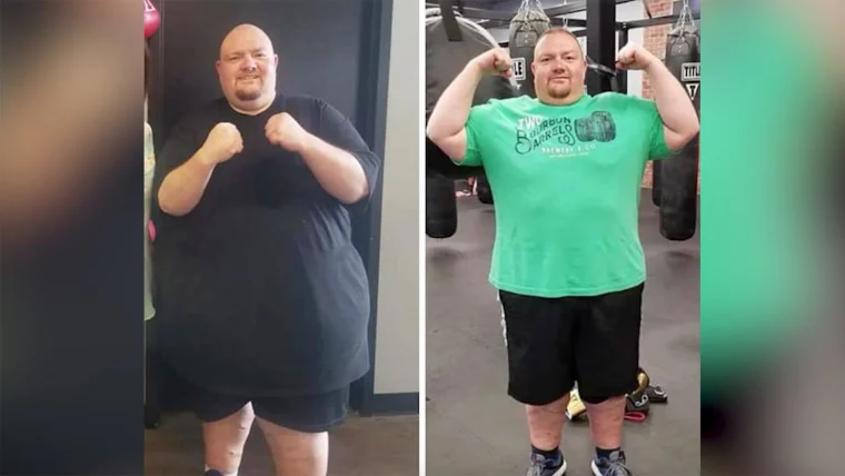 PCOS Weight Loss: Complete Exercise & Diet Plan [Dubai Specialist Guide]