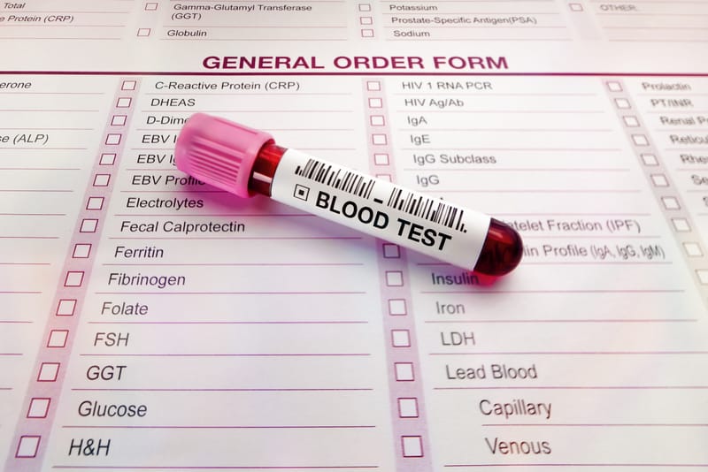 Why Your Blood Test Matters for Fat Loss