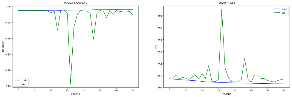 DenseNet Model Performance