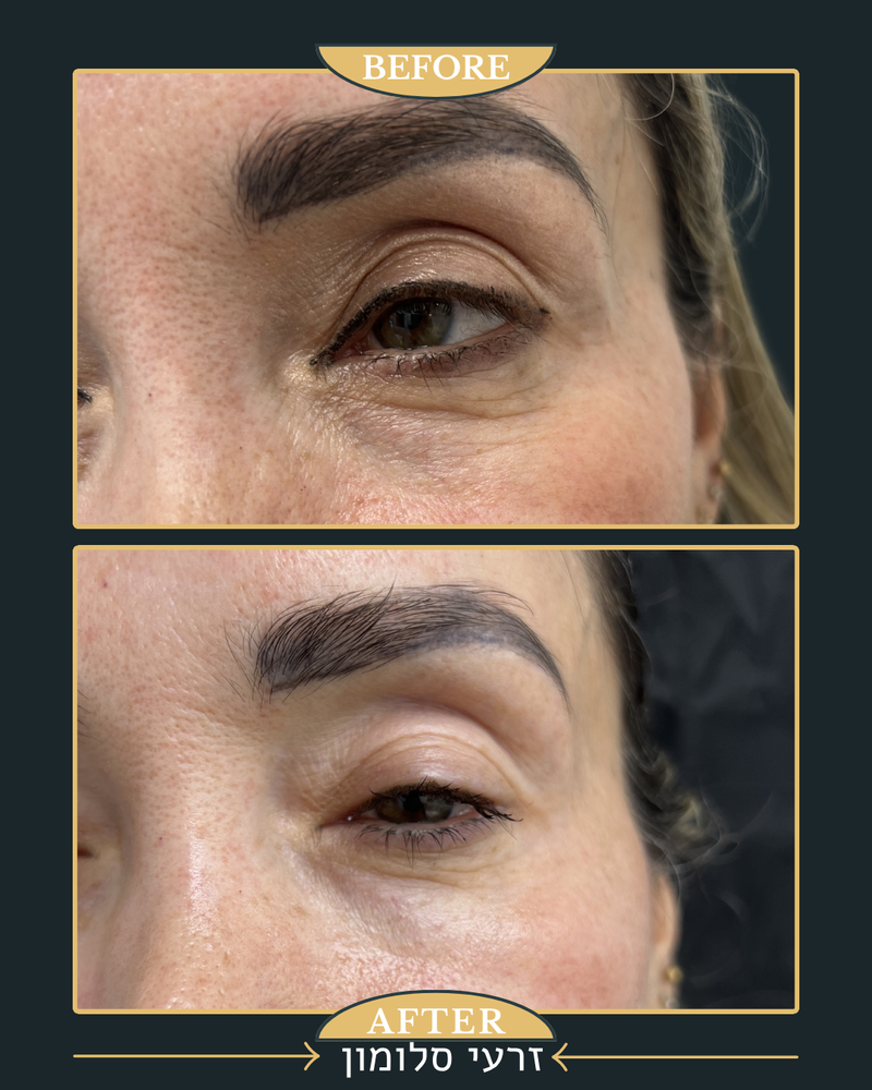 ביו סימולטורים מרקם עור 