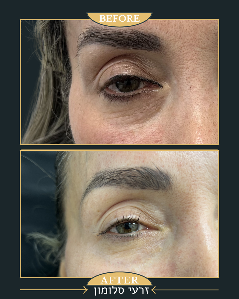 ביו סימולטורים מרקם עור 