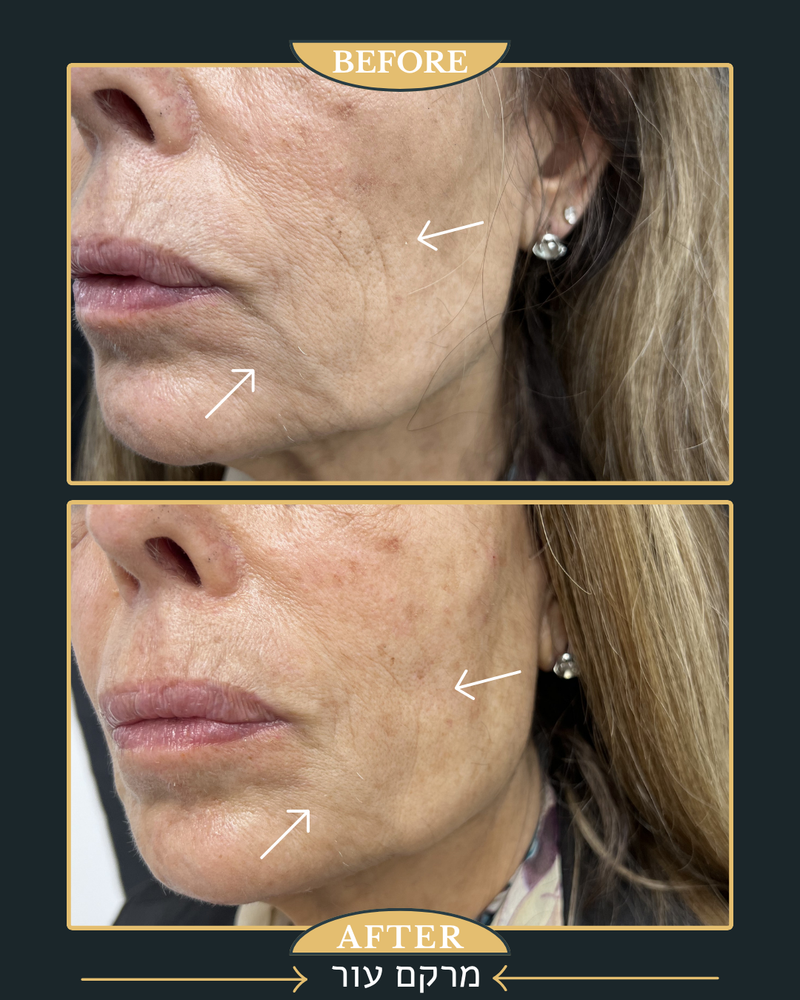 ביו סימולטורים מרקם עור 