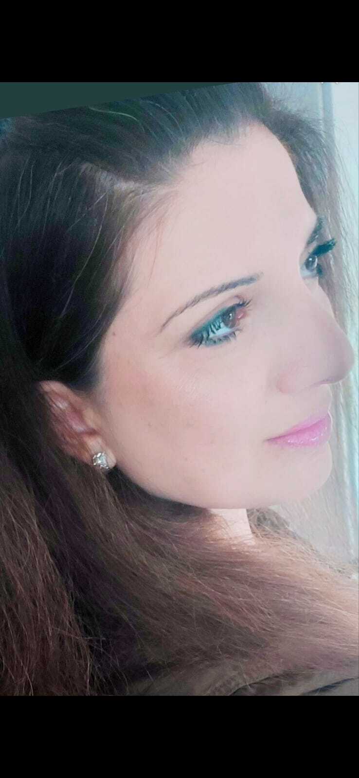 סימני מתיחה