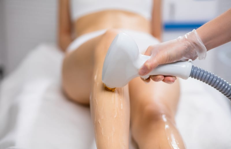 Laser Hair Removal