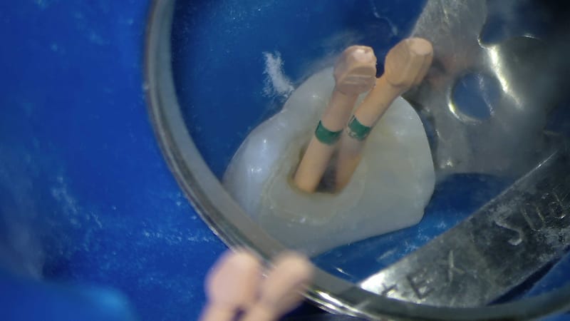 TRATAMENTO ENDODONTICO COM MICROSCÓPIO