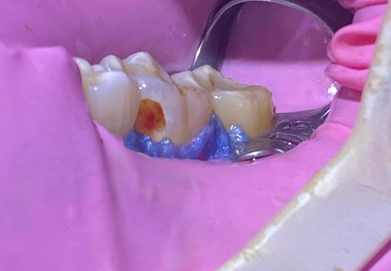 Em que situações ele pode ser utilizado?