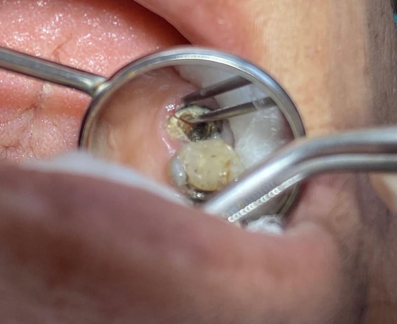 O que conseguimos diagnosticar com o microscópio?