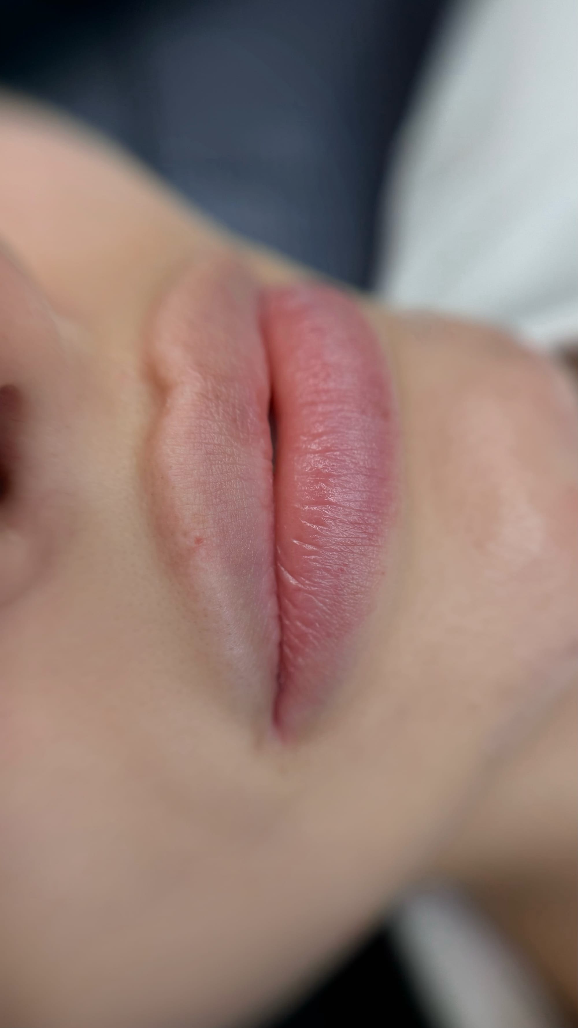 Raspberry - Lips