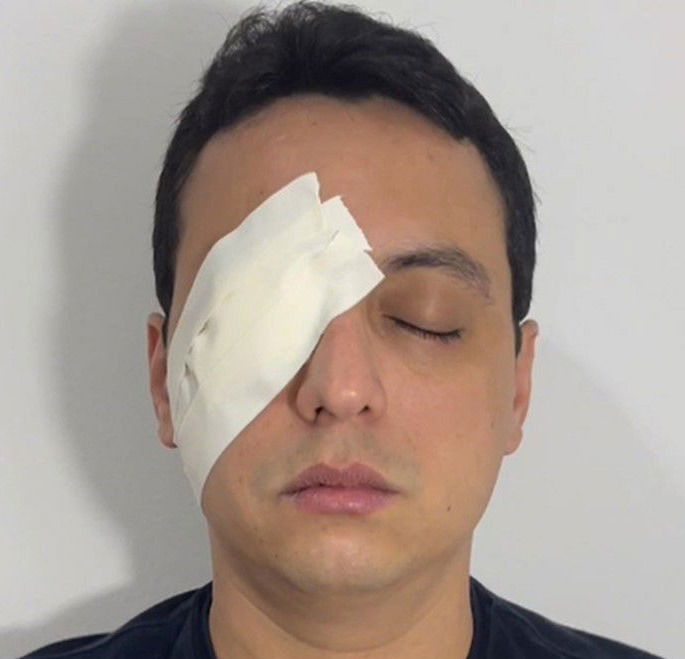 👁🗨 CURATIVO OCULAR COMPRESSIVO E NÃO COMPRESSIVO – DOMINE AS TÉCNICAS ESSENCIAIS!