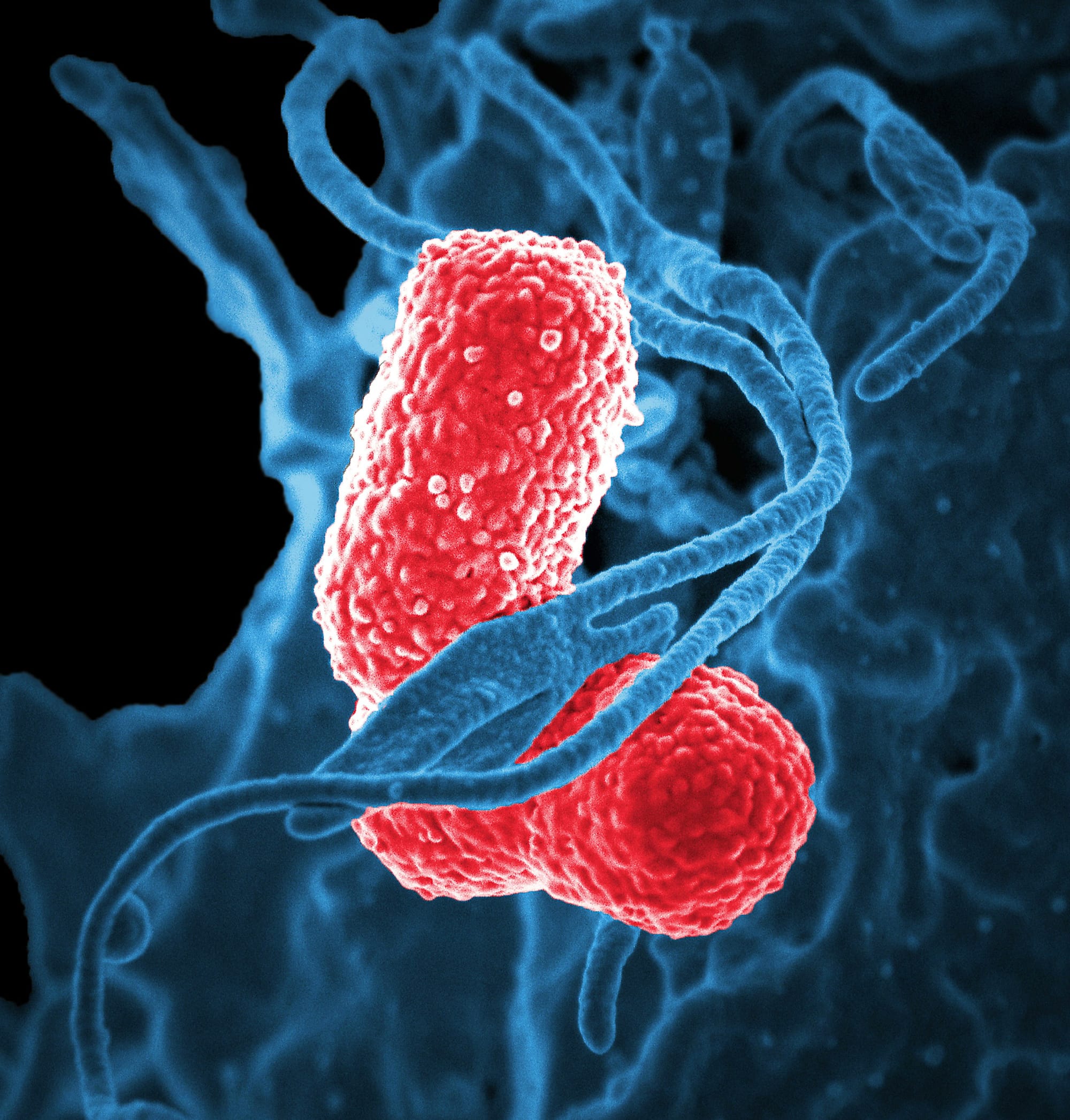 Pourquoi ton microbiote s'effondre même quand tu manges sainement