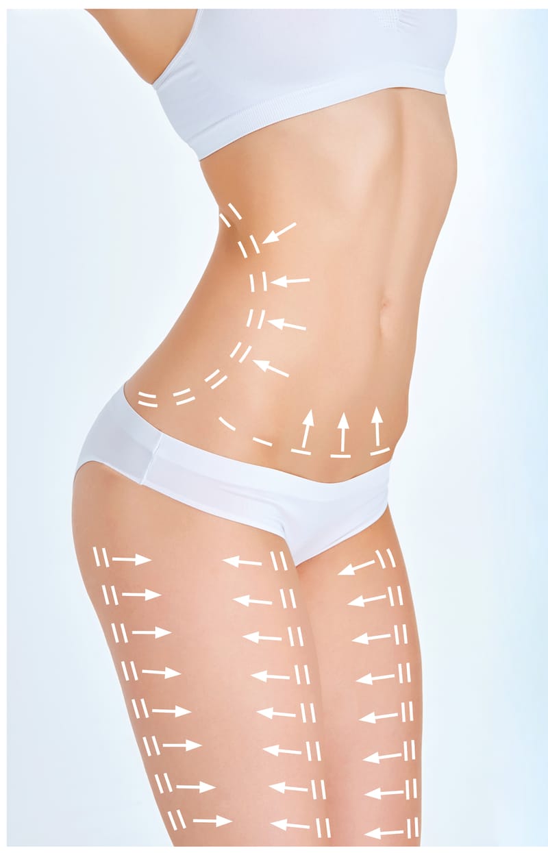 Body Contour Behandeling