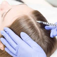 Intradermoterapia Capilar