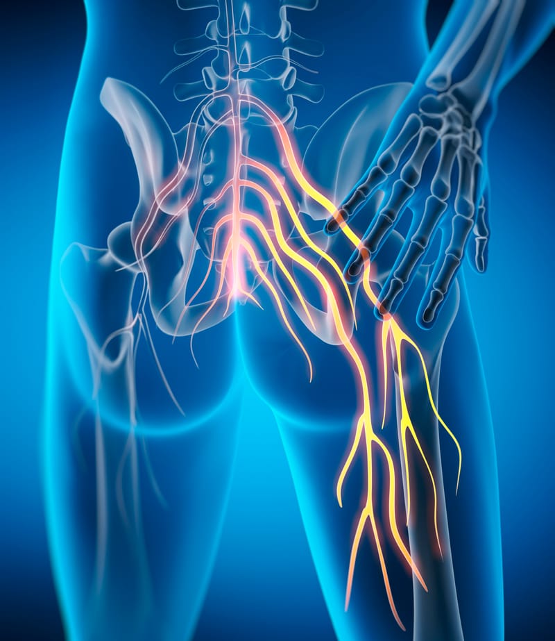 “Piriformis & Sciatic Relief and Restore Package: