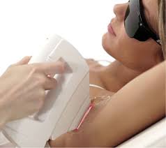 Epilation Définitive
