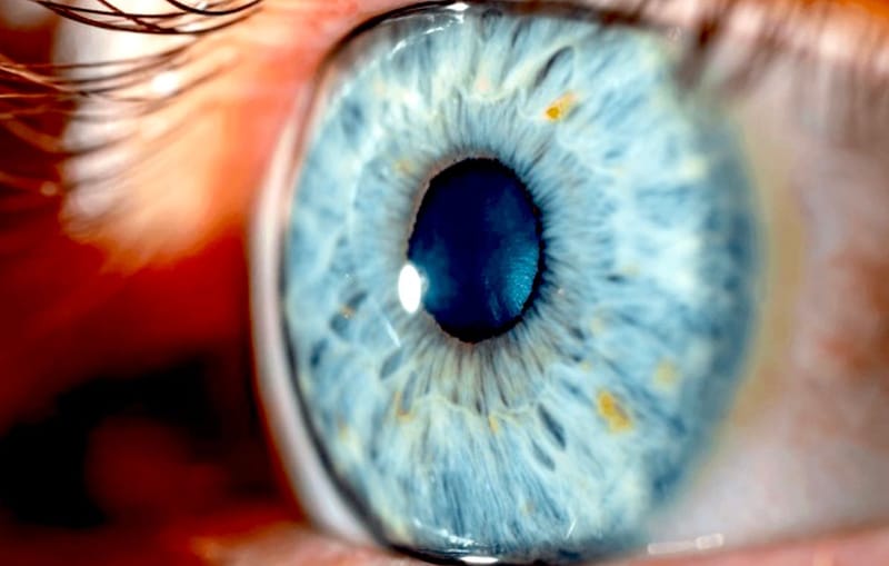 Iridology