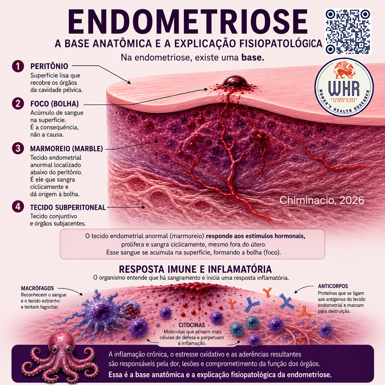 Understanding Endometriosis: The Octopus Concept