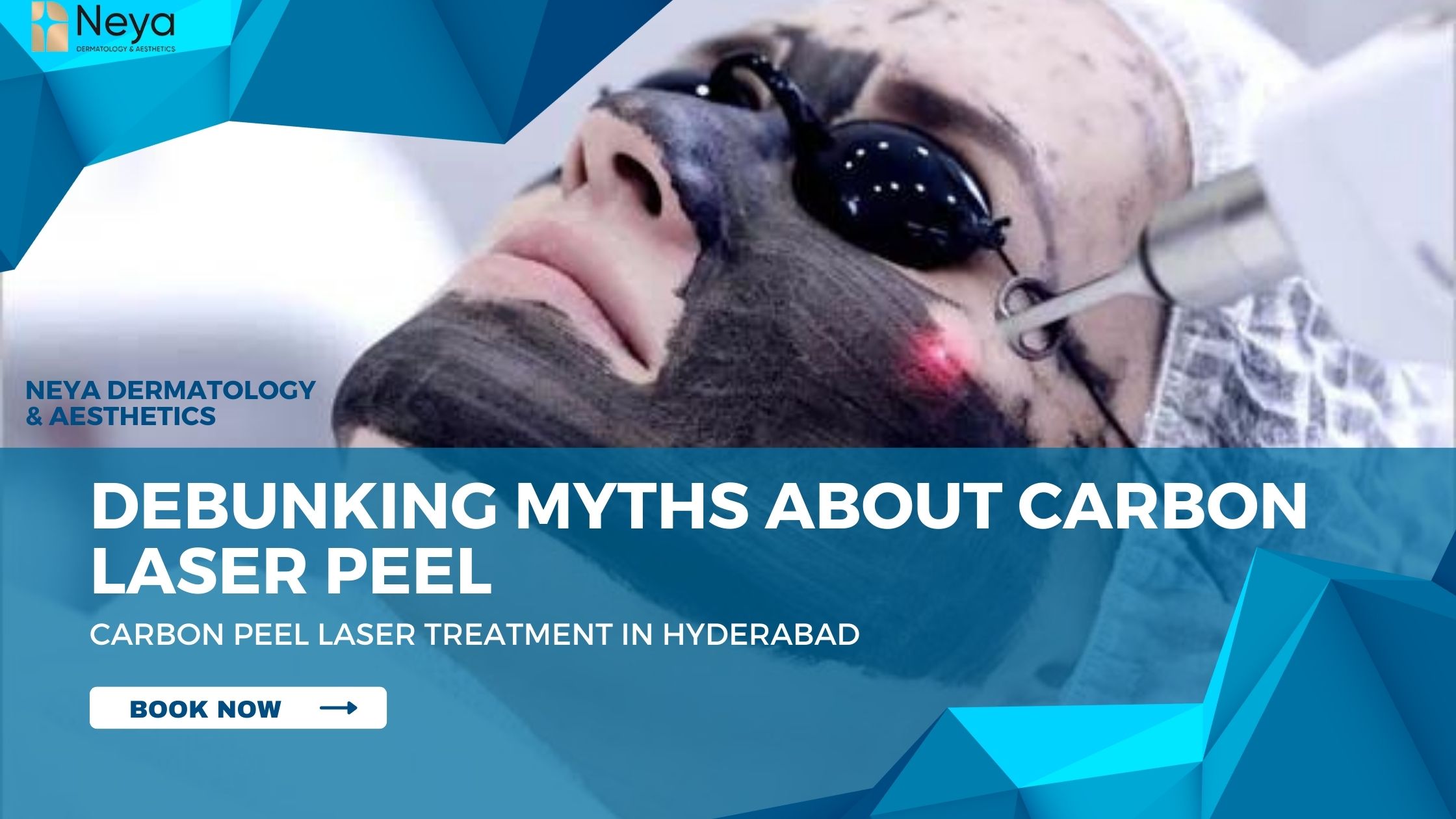 Myths About Carbon Laser Peel Treatment