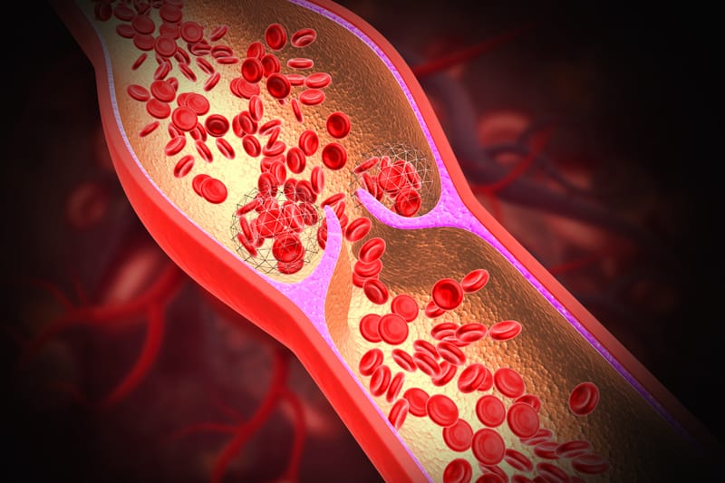 Fallos de implantación y abortos de repetición: cuando la coagulación de la sangre es la causa oculta