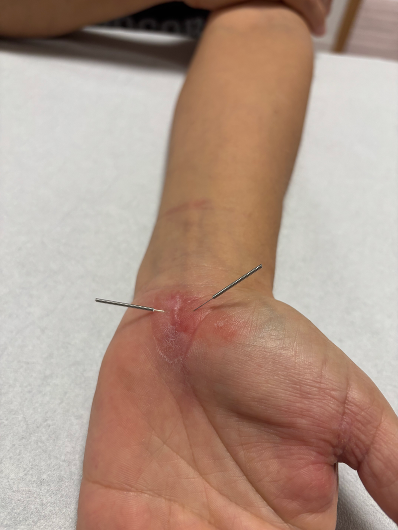 🩻 Fisioterapia General