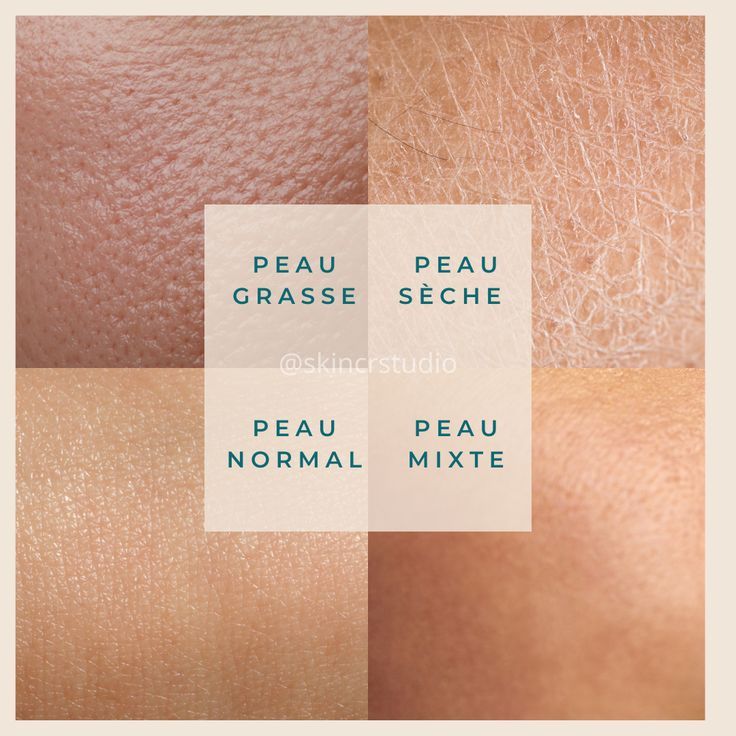 Comment connaître son type de peau en 5 minutes