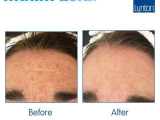 Illumi Course of 6 facials... 1 a month for 6 months....£300.00