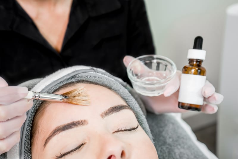Chemical Peels