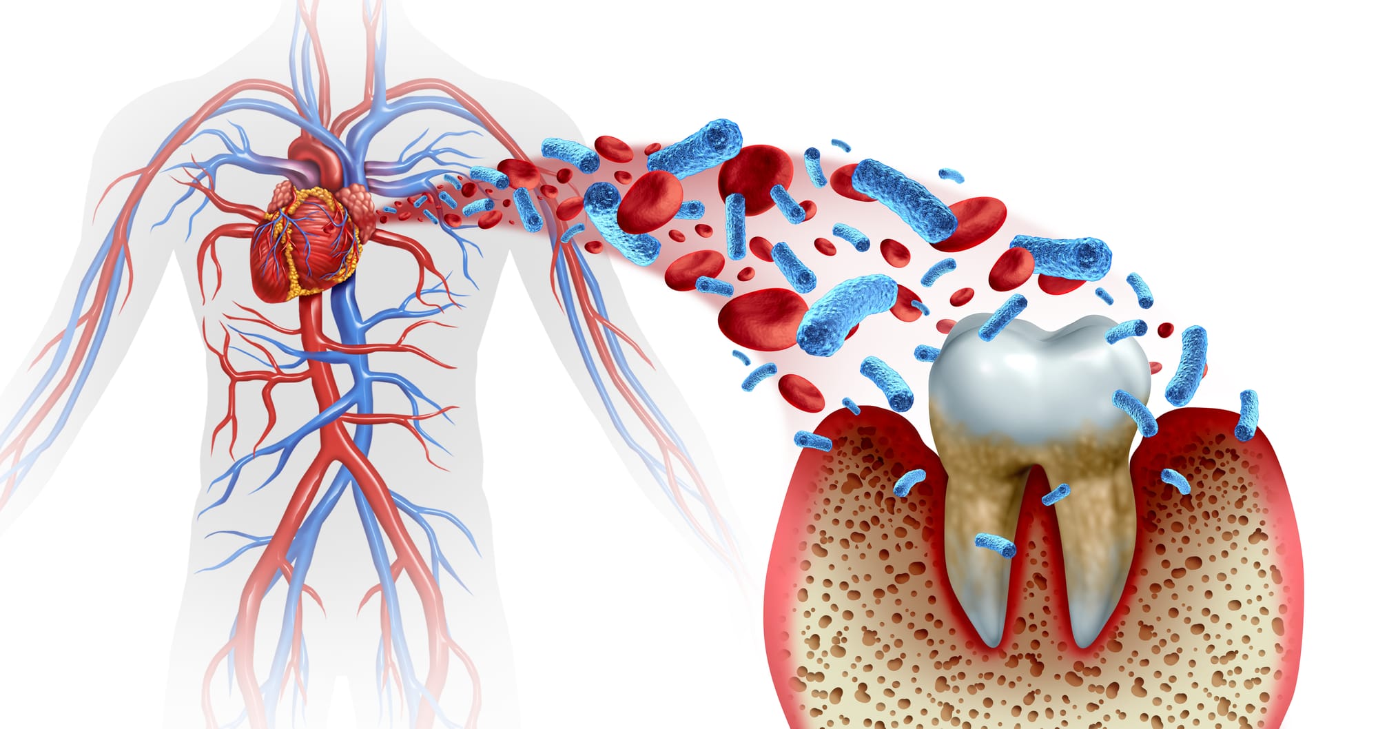 The Silent Epidemic: Why Your Gums Are the Gateway to Your Health